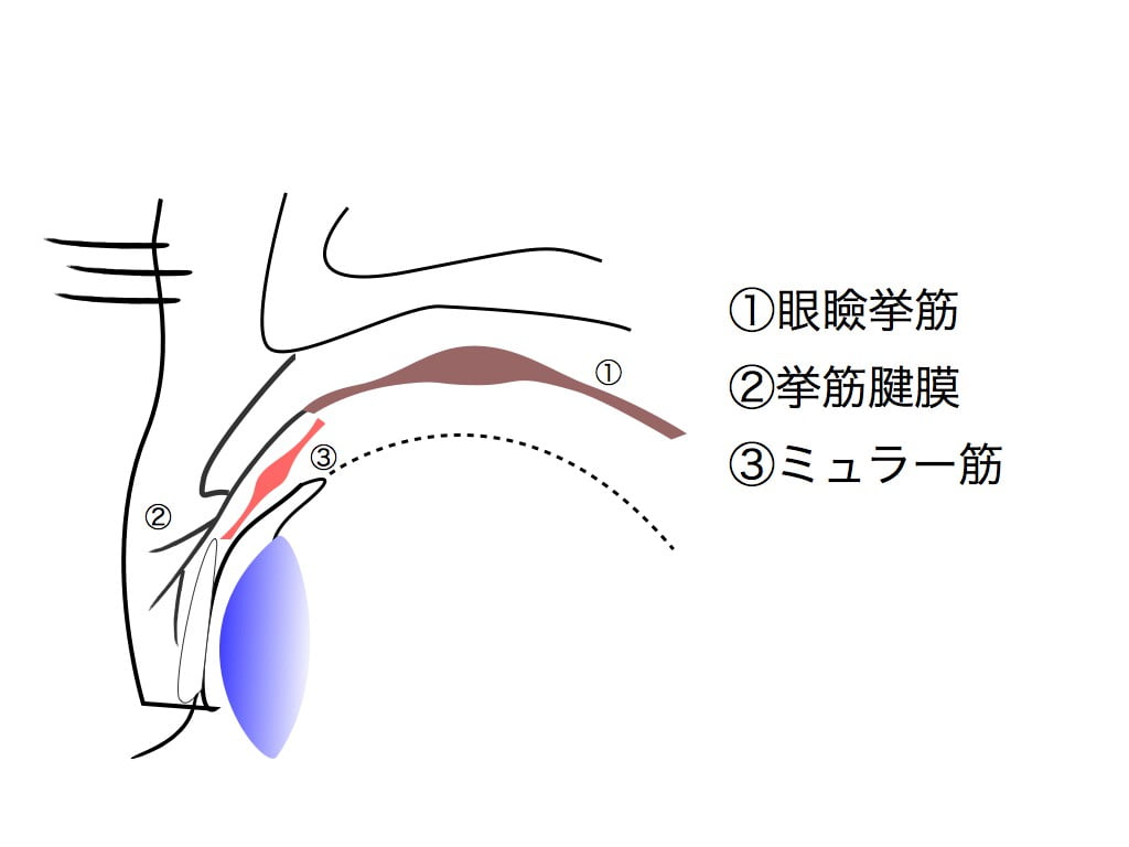 挙筋腱膜の下にいるミュラー筋