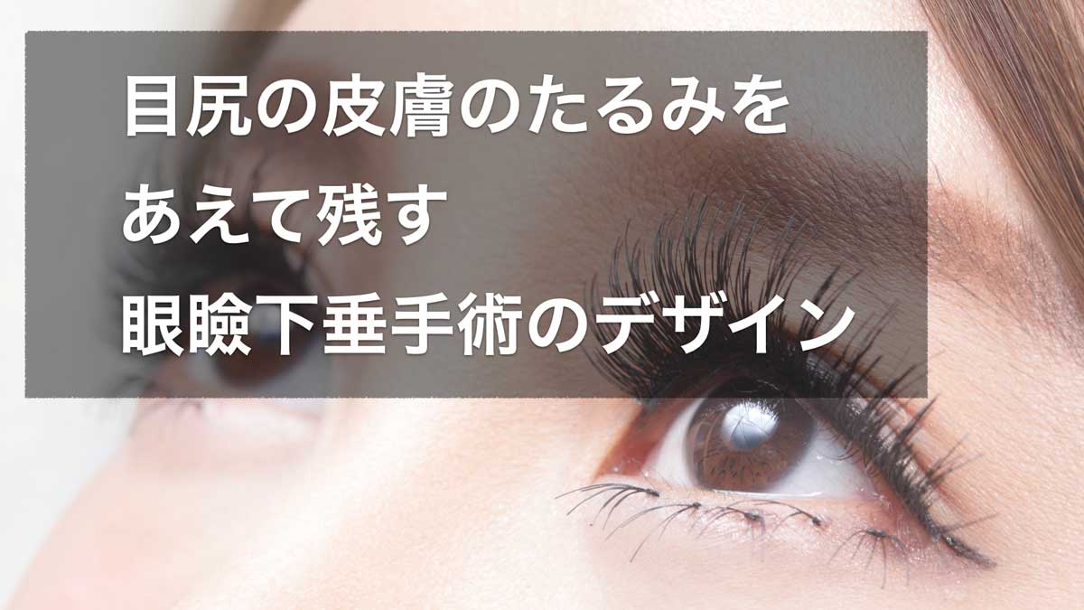 テールシャドウを残すデザイン