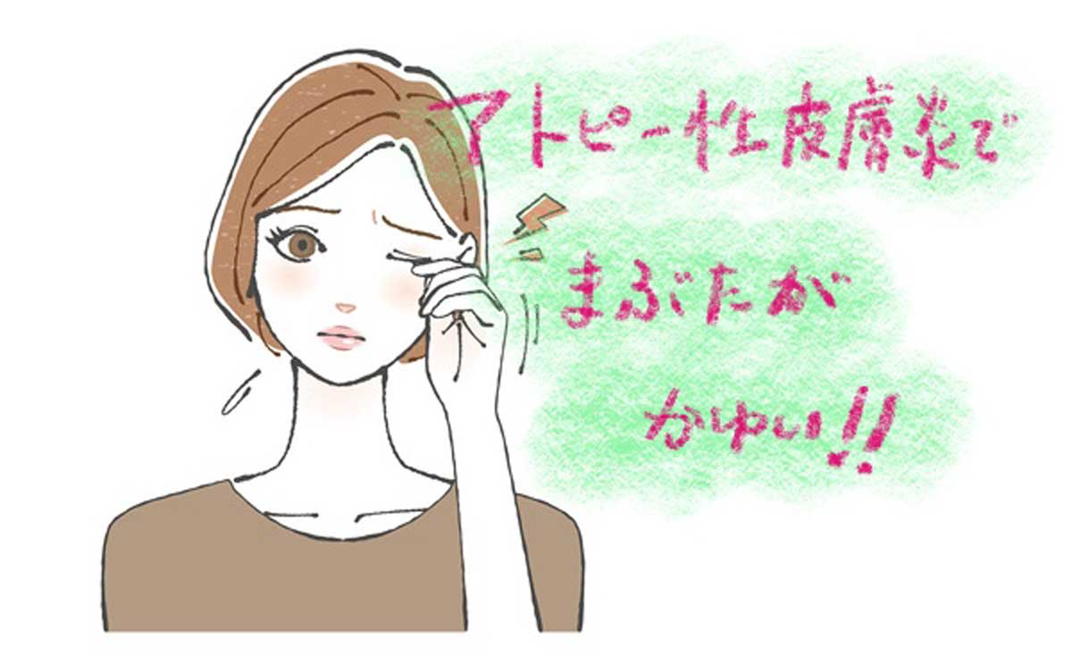アトピー性皮膚炎と眼瞼下垂