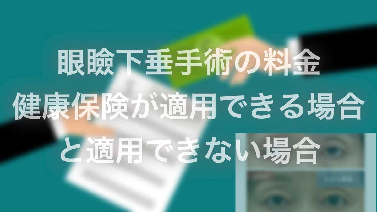 眼瞼下垂手術の健康保険適用
