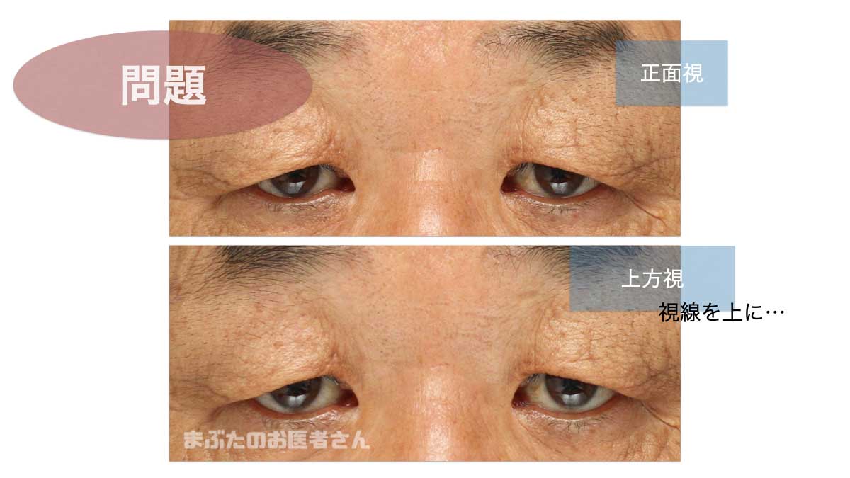 新型コロナウイルス感染症が目の問題を引き起こすのはなぜですか?