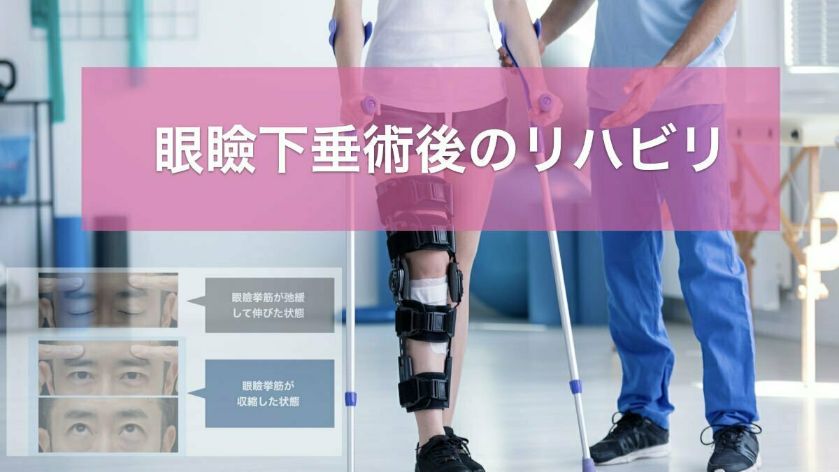 眼瞼下垂術後のリハビリ