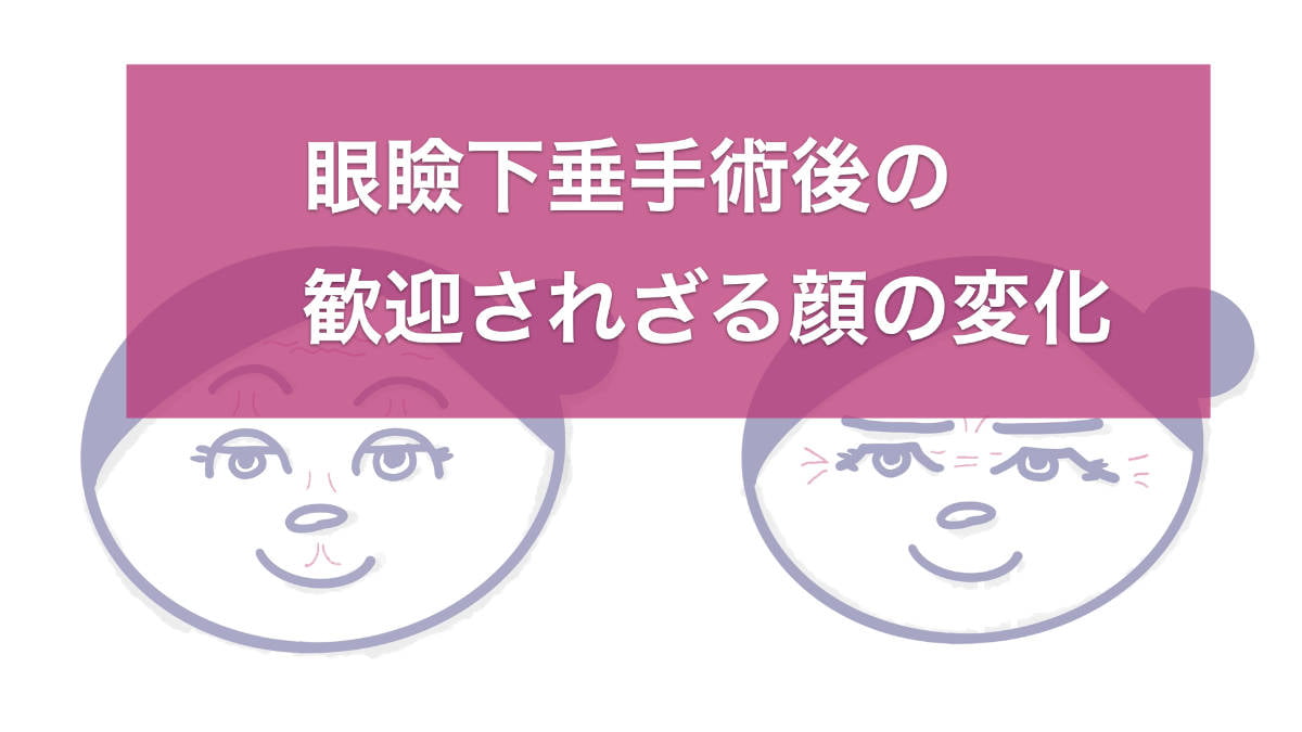 眼瞼下垂手術後の歓迎されざる顔の変化