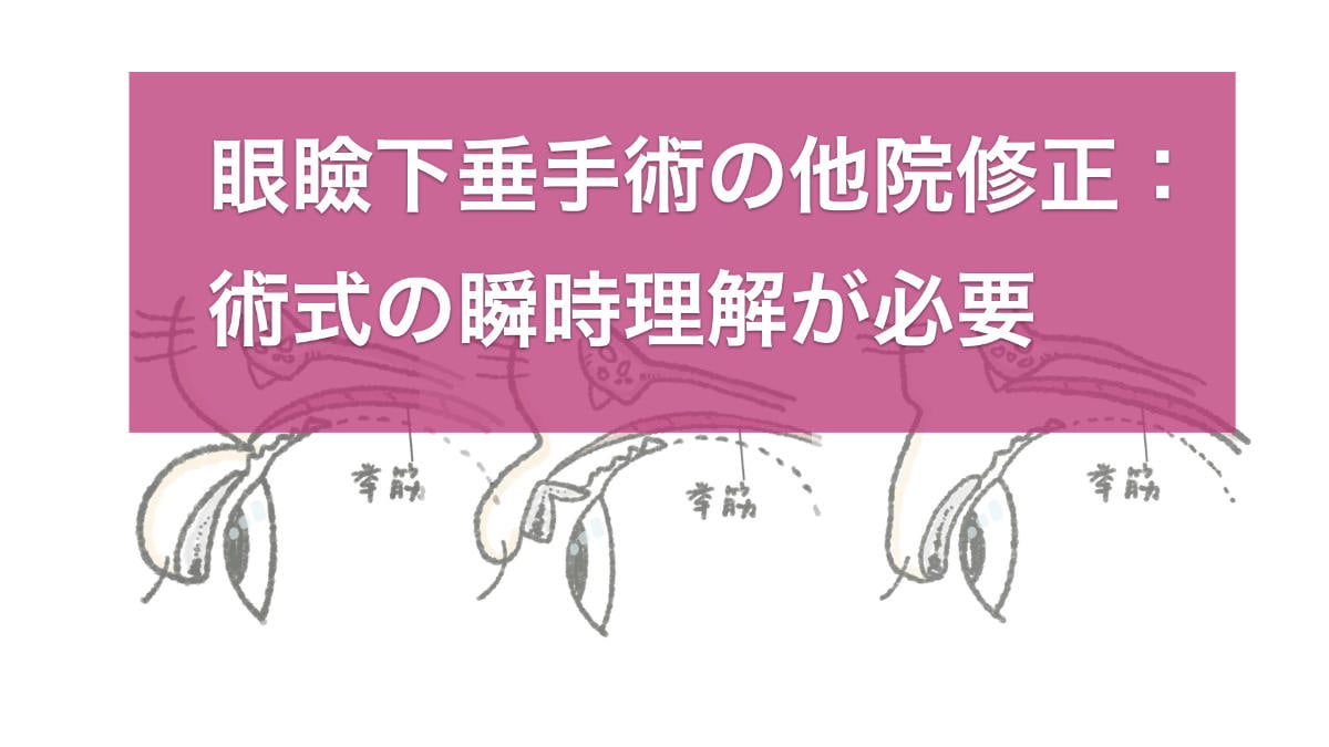 他院修正