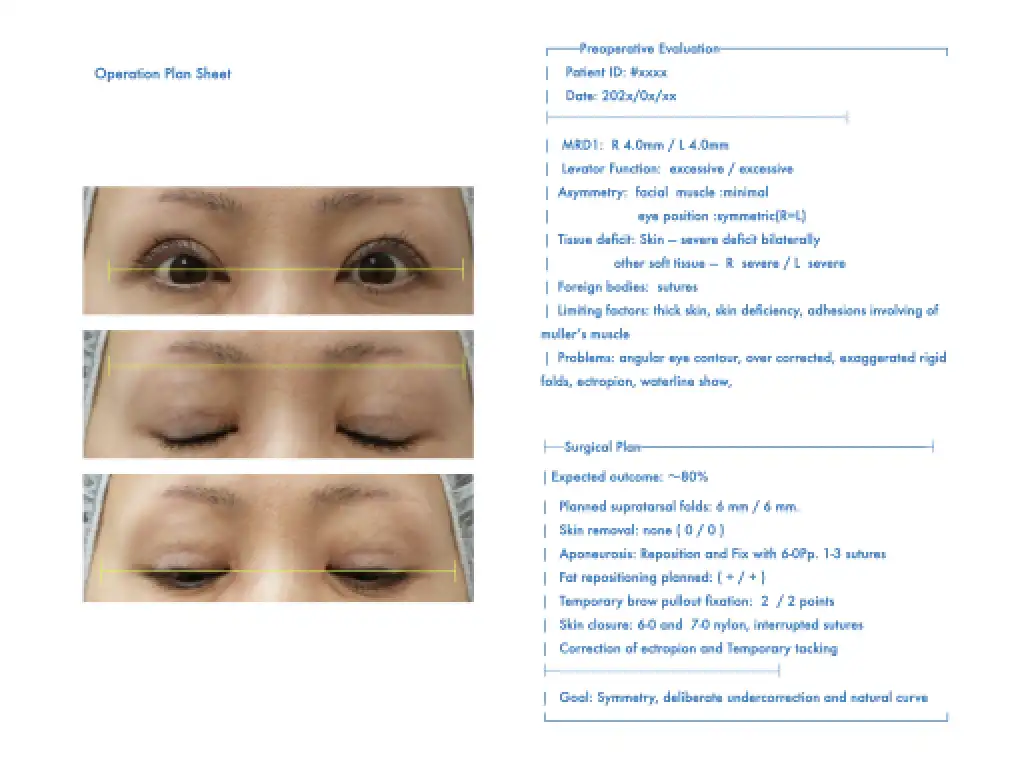 手術プランシートマスク付き