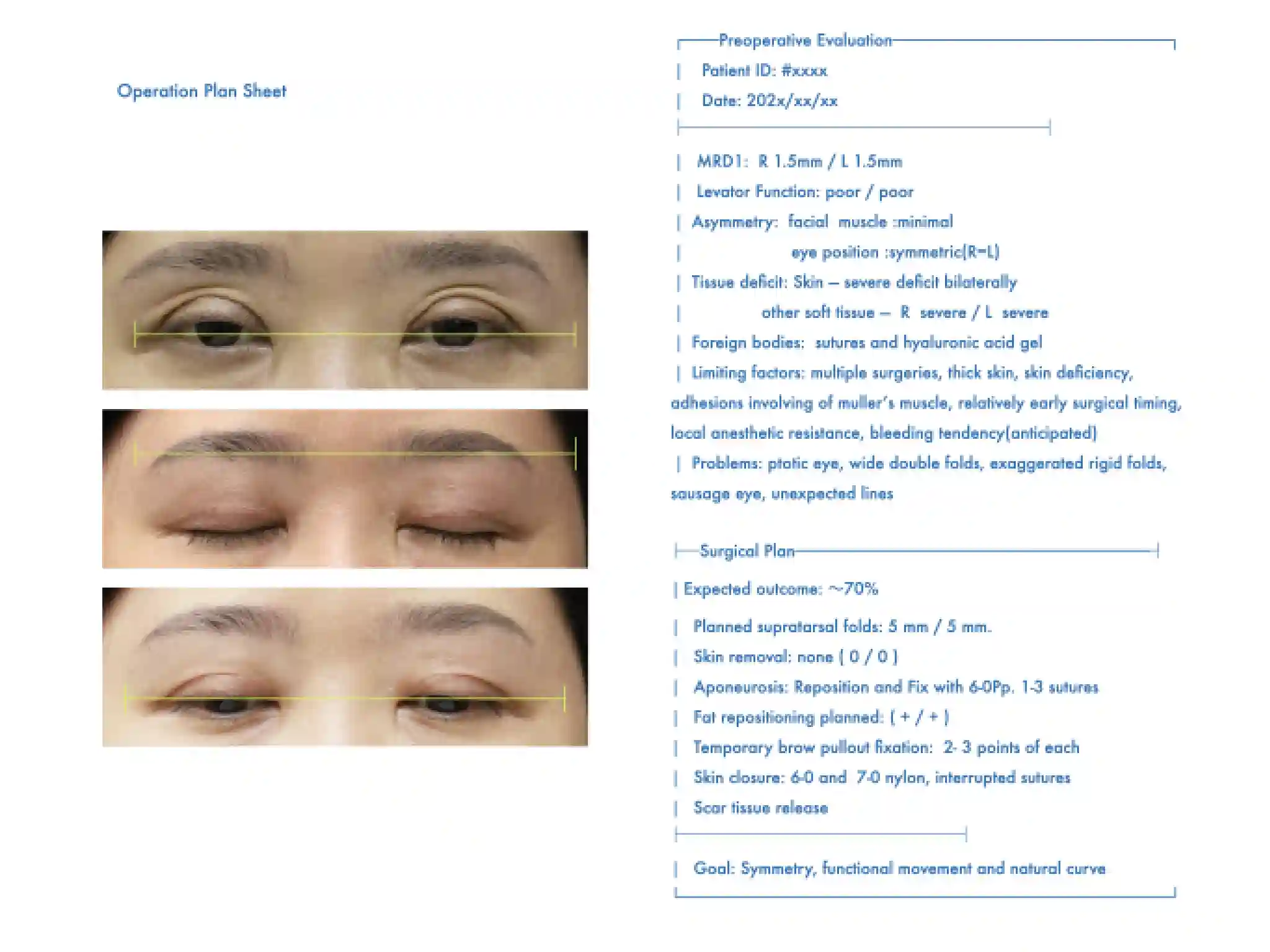 手術プラニングシート